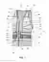Fig. 02 - Orthopedic device for scapulothoracic stabilization