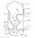 Fig. 01 - Back Brace