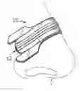 Fig. 01 - Overlapping resilient member structures in nasal dilator devices