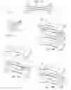 Fig. 08 - Overlapping resilient member structures in nasal dilator devices