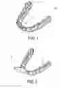 Fig. 02 - DENTAL APPLIANCE