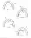 Fig. 02 - Apparatus for improved breathing