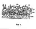 Fig. 02 - Absorbent article with a slitted absorbent core