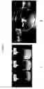 Fig. 06 - Abuse resistant pharmaceutical compositions
