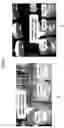 Fig. 08 - Abuse resistant pharmaceutical compositions