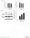 Fig. 02 - COMPOSITIONS AND METHODS FOR TREATING BONE DISEASES