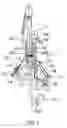 Fig. 02 - Airway stabilization system