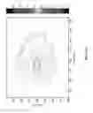 Fig. 49 - System and methods of photon-based radiotherapy and radiosurgery delivery