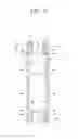 Fig. 12 - FILTER DEVICE