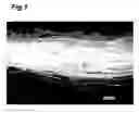 Fig. 02 - Aggregate-removing filter material, aggregate removal method, white blood cell-removing filter, and blood product filtering method