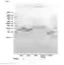 Fig. 02 - Reprogramming cells to a less differentiated state