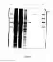 Fig. 09 - Nucleic acid sequence segment for enhancing protein expression