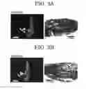 Fig. 04 - DNA Having Anther-Specific Promoter Activity, and Utilization Thereof