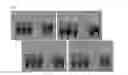 Fig. 07 - STABILIZATION AND ISOLATION OF EXTRACELLULAR NUCLEIC ACIDS