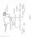 Fig. 11 - Non-replicative transduction particles and transduction particle-based reporter systems