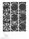 Fig. 24 - Non-replicative transduction particles and transduction particle-based reporter systems