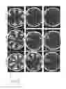 Fig. 24 - Non-replicative transduction particles and transduction particle-based reporter systems