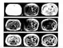 Fig. 01 - Interactive non-uniformity correction and intensity standardization of MR images