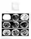 Fig. 02 - Interactive non-uniformity correction and intensity standardization of MR images