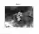 Fig. 02 - Production of plants using somatic embryogenesis