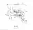 Fig. 02 - Balloon catheter with image capture and light emission features