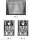Fig. 02 - ONE OR MORE TWO DIMENSIONAL (2D) PLANNING PROJECTION IMAGES BASED ON THREE DIMENSIONAL (3D) PRE-SCAN IMAGE DATA