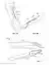 Fig. 09 - SURGICAL DEVICE AND METHODS