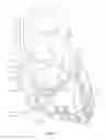 Fig. 02 - Operating a vessel occlusion catheter