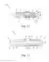 Fig. 08 - Bone compression screws