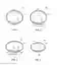 Fig. 02 - FLUID-FILLED IMPLANTABLE STRUCTURES WITH INTERNAL SURFACE-MODIFYING COMPONENTS AND RELATED METHODS