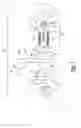 Fig. 02 - Glenoid trial and implant assembly for reverse total shoulder arthroplasty and method of use