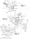 Fig. 06 - Glenoid trial and implant assembly for reverse total shoulder arthroplasty and method of use