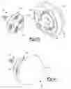 Fig. 09 - Glenoid trial and implant assembly for reverse total shoulder arthroplasty and method of use