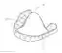 Fig. 01 - NASAL RELIEF AND SNORING STOPPING DEVICE