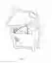 Fig. 04 - NASAL RELIEF AND SNORING STOPPING DEVICE