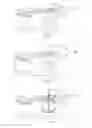 Fig. 05 - Medical device for treating abscesses