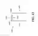 Fig. 85 - Negative pressure wound closure device