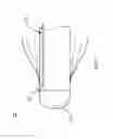 Fig. 08 - Using a guided member to facilitate brachytherapy device swap