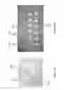 Fig. 07 - Focused ultrasound apparatus and methods of use