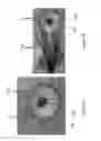 Fig. 09 - Focused ultrasound apparatus and methods of use