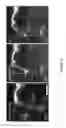 Fig. 16 - Focused ultrasound apparatus and methods of use