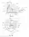 Fig. 14 - Golf club head