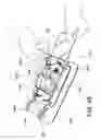 Fig. 45 - Cradle device and method of using the same