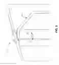 Fig. 06 - Bonded mount ring spinner
