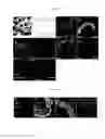 Fig. 02 - Method for manufacturing telencephalon or progenitor tissue thereof