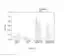 Fig. 08 - Methods of capturing sperm nucleic acids