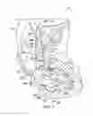 Fig. 05 - Intergland grease