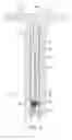 Fig. 09 - Standing injection valve with hydraulically dampened valve closure