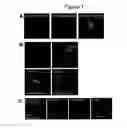 Fig. 02 - Functional Targeted Brain Endoskeletonization
