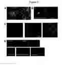 Fig. 03 - Functional Targeted Brain Endoskeletonization